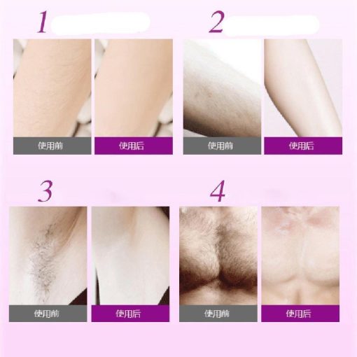 hair removal at home