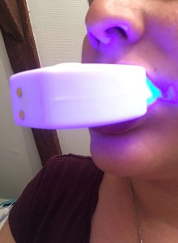 Best Teeth Whitening Automatic Toothbrush photo review